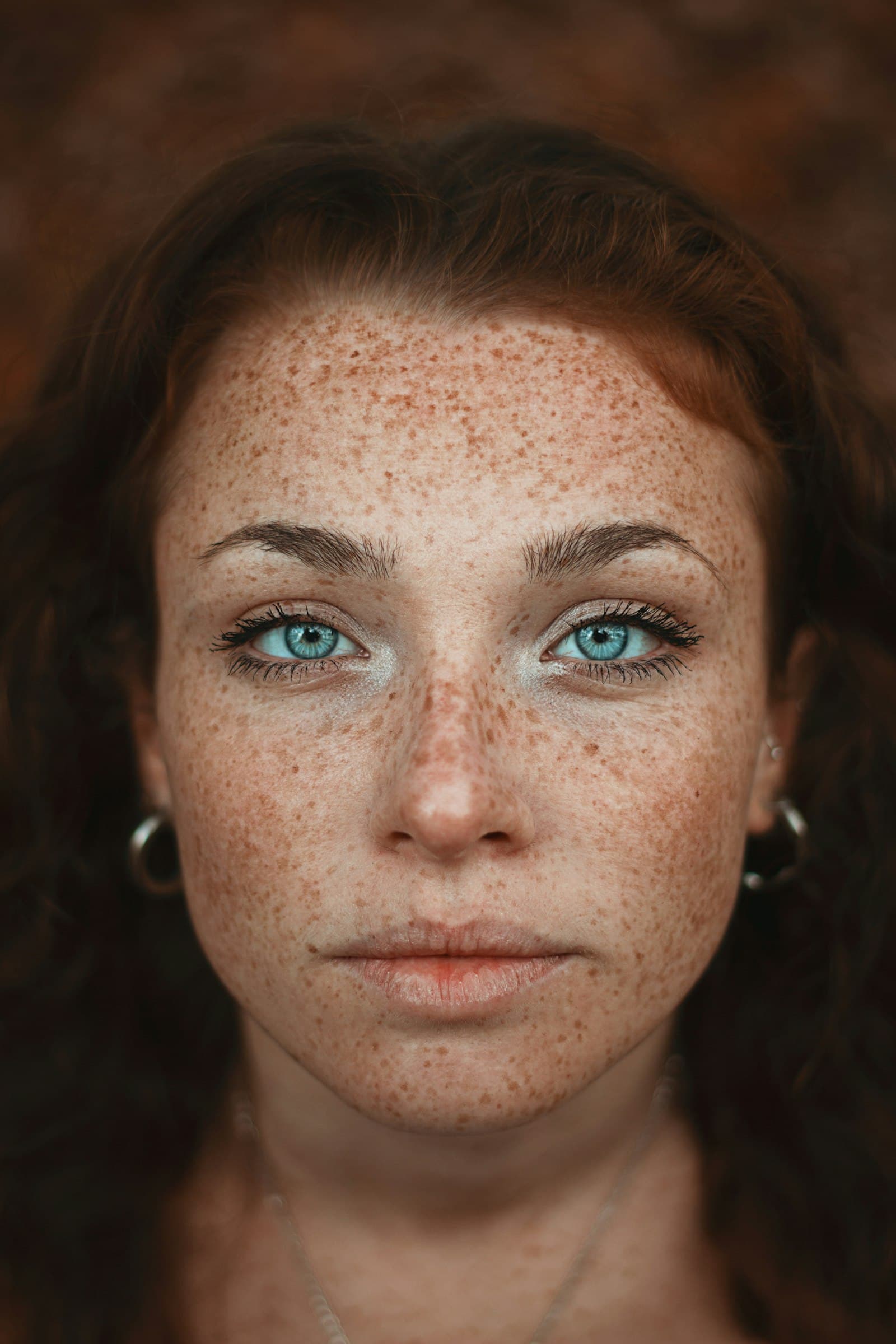 Woman with blue eyes and many freckles across her face, nose and forehead
